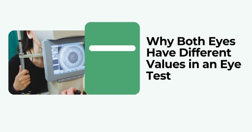 Different Values in an Eye Test